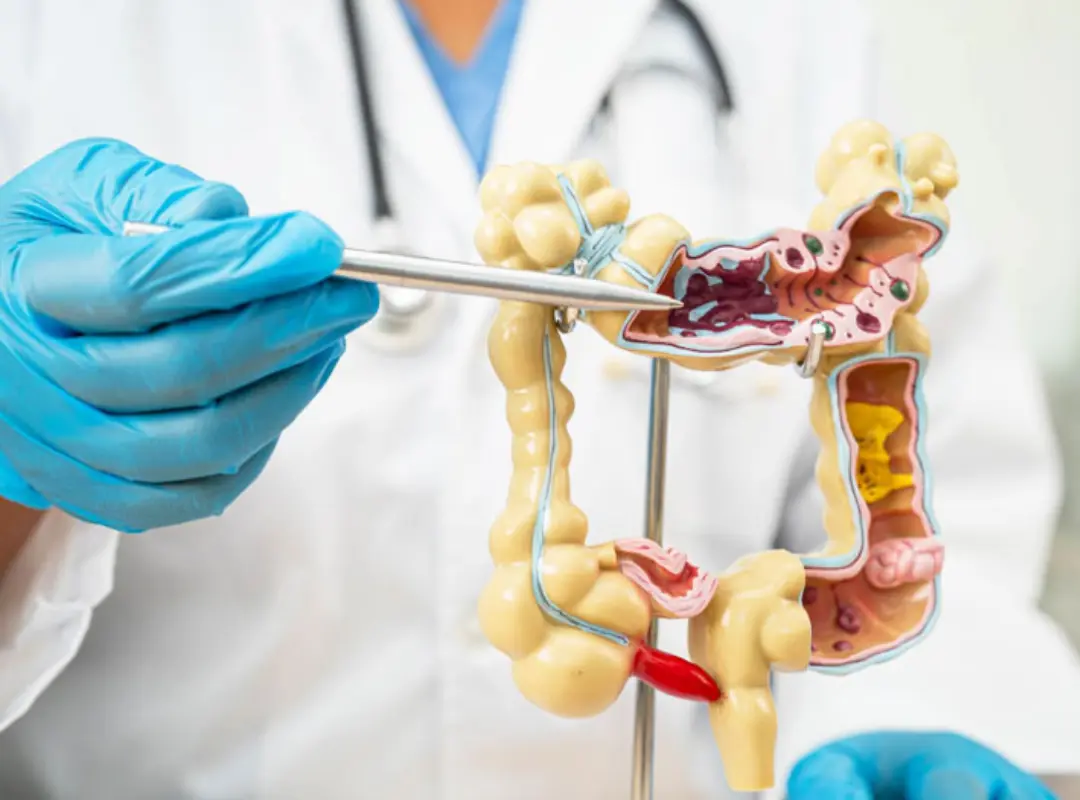 Colorectal Surgery
