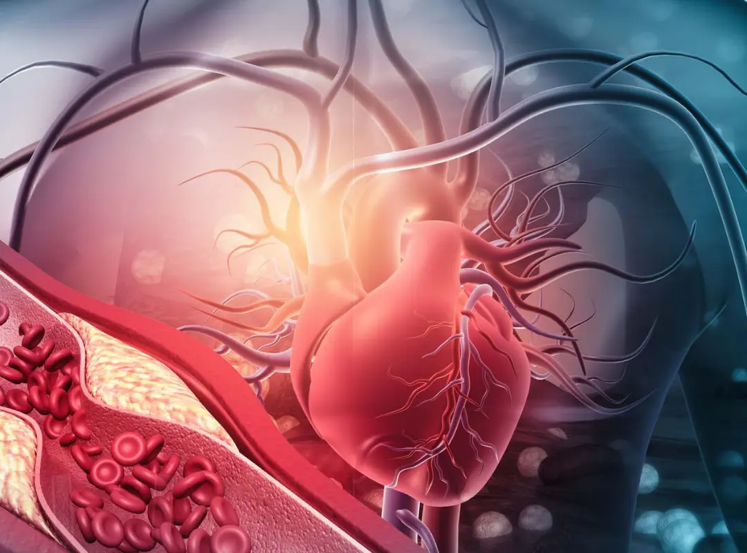 Vascular Surgery