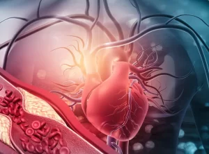 Vascular Surgery Vascular Surgery
